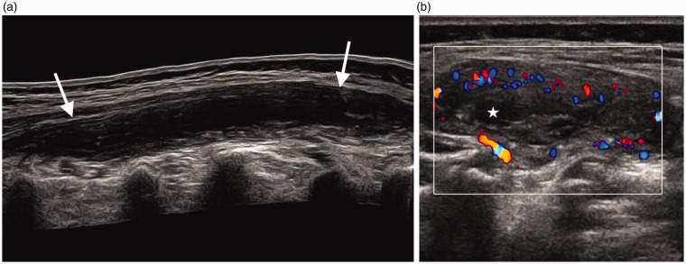 Figure 15.