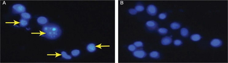 Figure 1A & B: