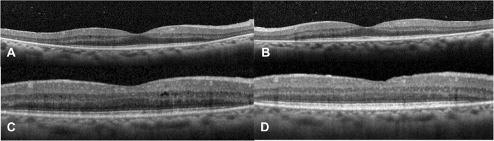 Fig. 3