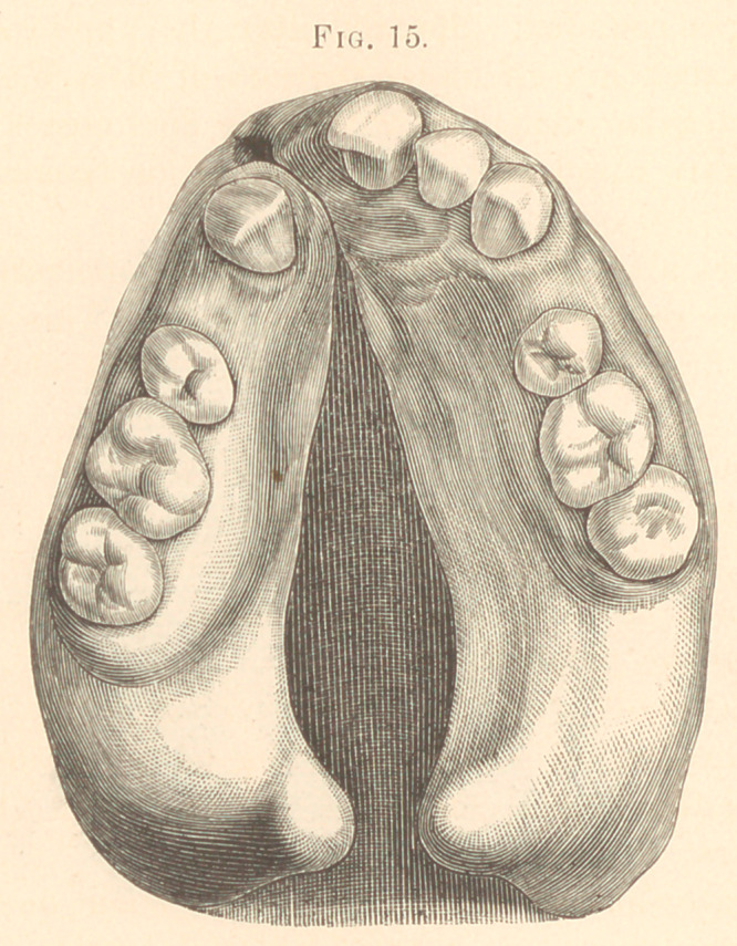 Fig. 15.