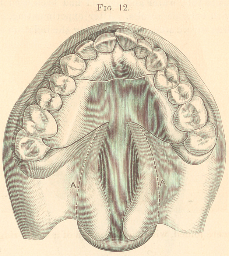 Fig. 12.