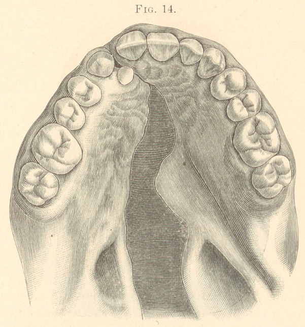 Fig. 14.