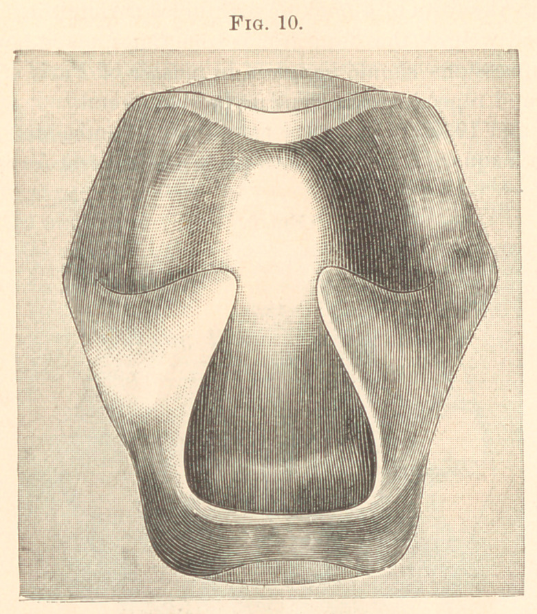 Fig. 10.