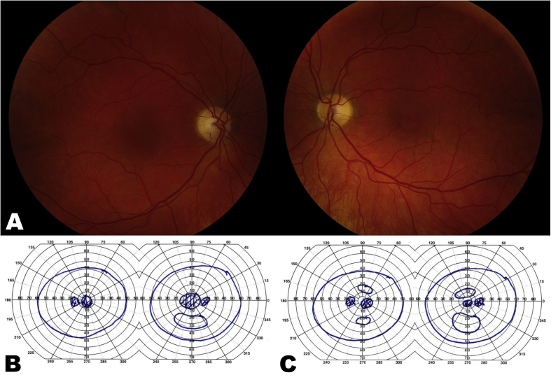 Fig. 2