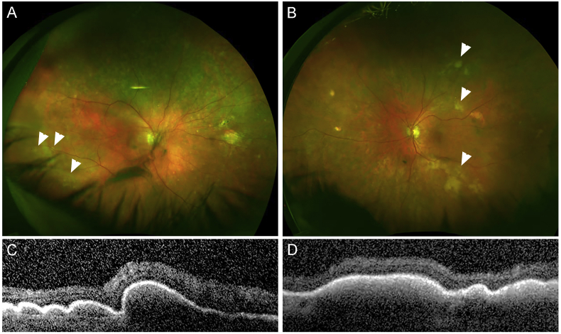 Fig. 1