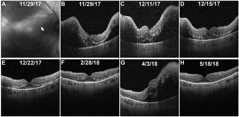 Fig. 3