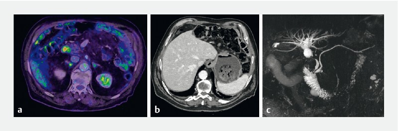 Fig. 1