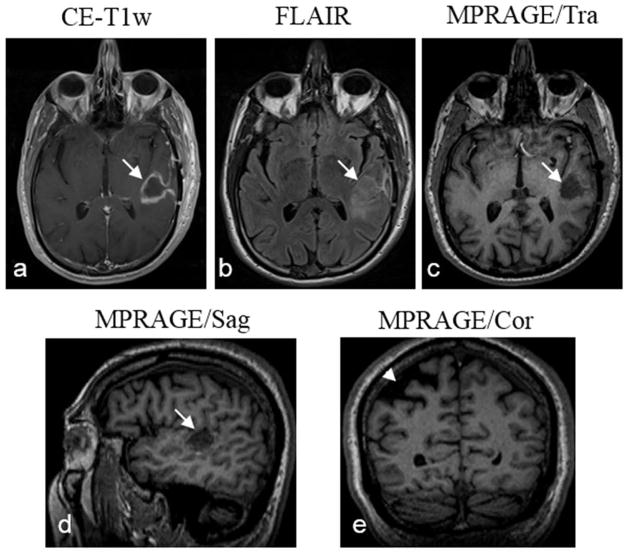 Fig. 10