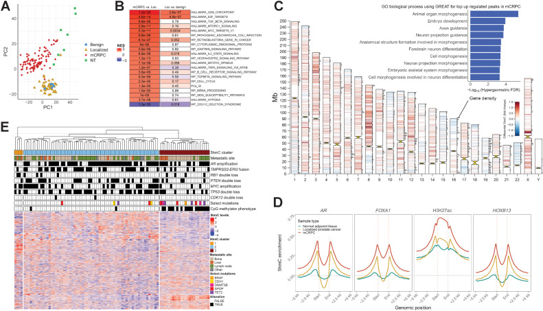 Figure 2. 5hmC patterns change at different states and subgroups of prostate cancer. A, Unsupervised visualization of global 5hmC patterns for different prostate cancer states using principal component analysis for gene body counts of the top 10% variable protein coding genes. Benign; benign prostate tissue, Localized; localized prostate cancer, mCRPC; metastatic castration-reisistant prostate cancer, NT; normal adjacent tissue (to mCRPC biopsy). B, Differential 5hmC gene body analysis between mCRCP (N = 93) and localized prostate cancer (N = 52), and localized prostate cancer and benign prostate (N = 5), respectively. Genes were ranked by the DESeq2 statistic and further analyzed by GSEA. Color represents the normalized enrichment score (NES) and adjusted p-values are shown for each pathway and state transition. Top significant pathways are shown. C, Differential 5hmC analysis for consensus peaks between localized prostate cancer and mCRPC. 5hmC peaks called by MACS2 for each sample were unified to a consensus set of peaks and used for differential analysis. Peaks with significant differences (FDR < 0.00001) are visualized per chromosome; red indicates upregulation in mCRPC and blue represents downregulation in mCRPC. Horizontal bars on chromosomes represent protein coding gene density. The most significant upregulated peaks (FDR < 0.001 and fold change > 1.5) in mCRPC were further analyzed by the GREAT tool for gene ontology biological processes, and the top 10 enriched biological processes by the hypergeometric test are shown as an insert (44). D, 5hmC enrichment at AR, FOXA1, HOXB13 and H3K27ac sites previously reported in mCRPC xenografts (21). 5hmC enrichment was calculated per sample and then averaged for localized prostate cancer (N = 52), normal adjacent tissue to mCRPC biopsies (N = 7), and mCRPC tissue samples (N = 93). E, Unsupervised hierarchical clustering of mCRPC tissue samples using 5hmC gene body counts of the top 10% most variable protein coding genes. Other means other metastatic soft tissue site. CMP; CpG methylator phenotype, NES; normalized enrichment score, Loc; Localized prostate cancer.