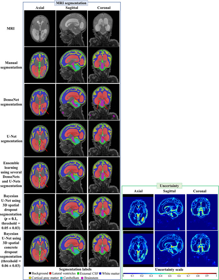 FIGURE 6