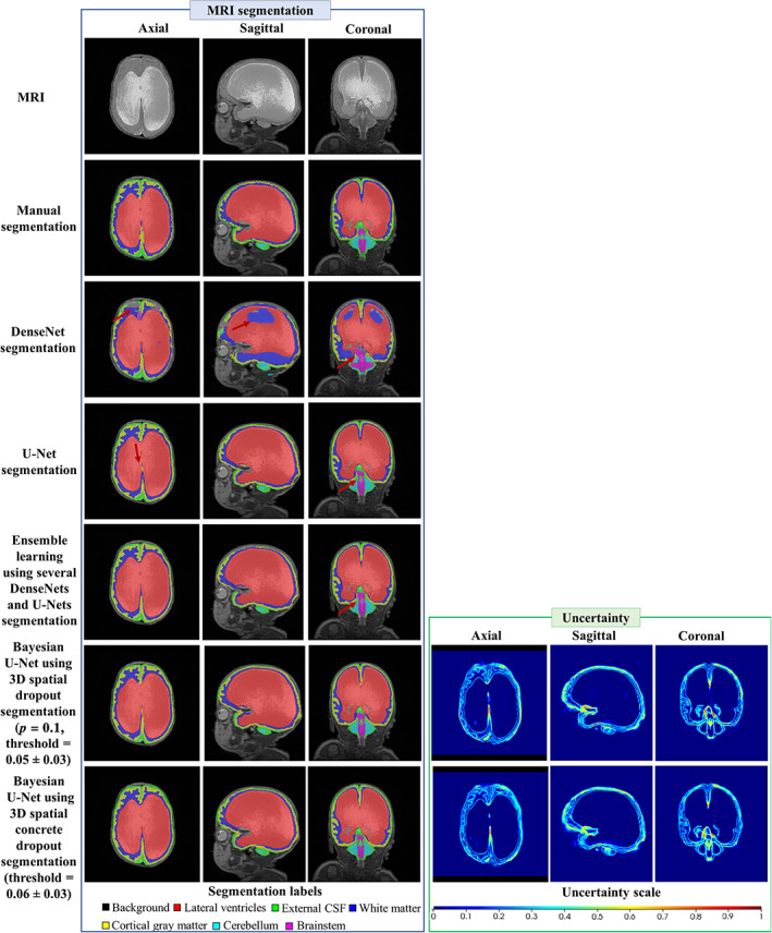 FIGURE 3