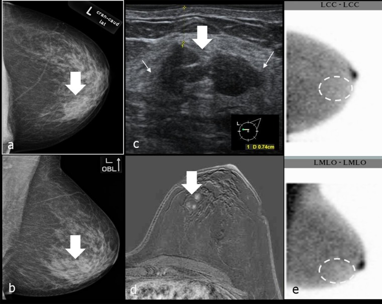 Figure 11.