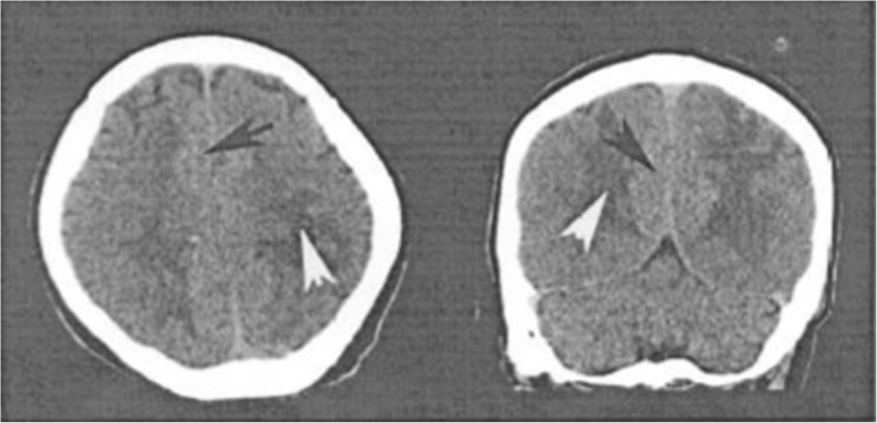 Fig.1