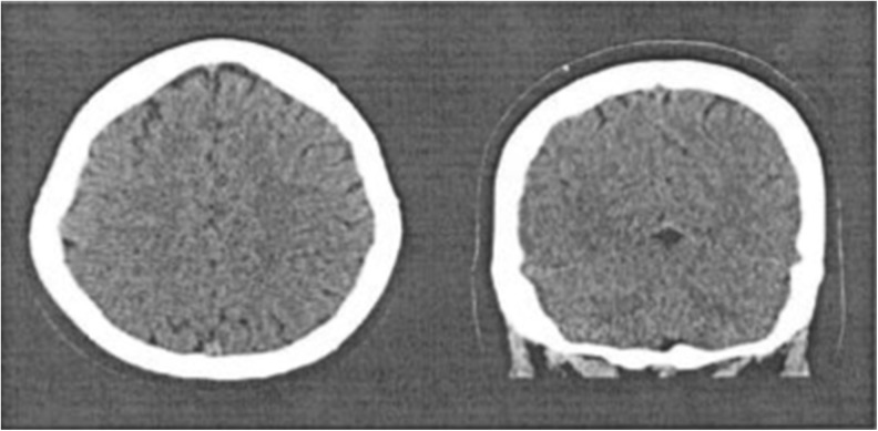 Fig.2