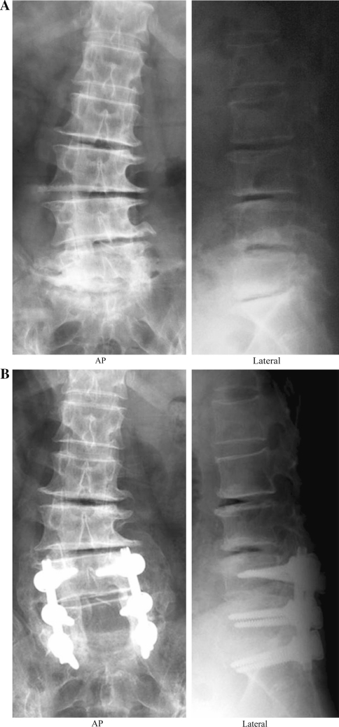 Fig. 1