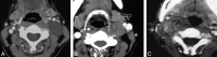 Fig 1.