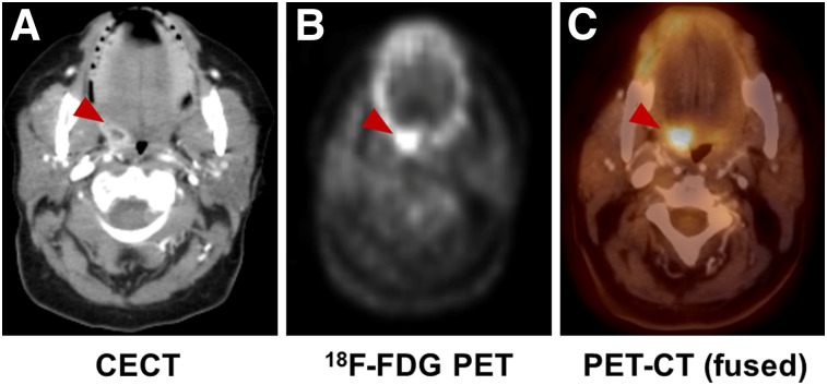 FIGURE 4.