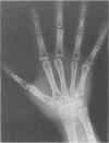 515