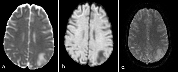 [Table/Fig-2a-c]: