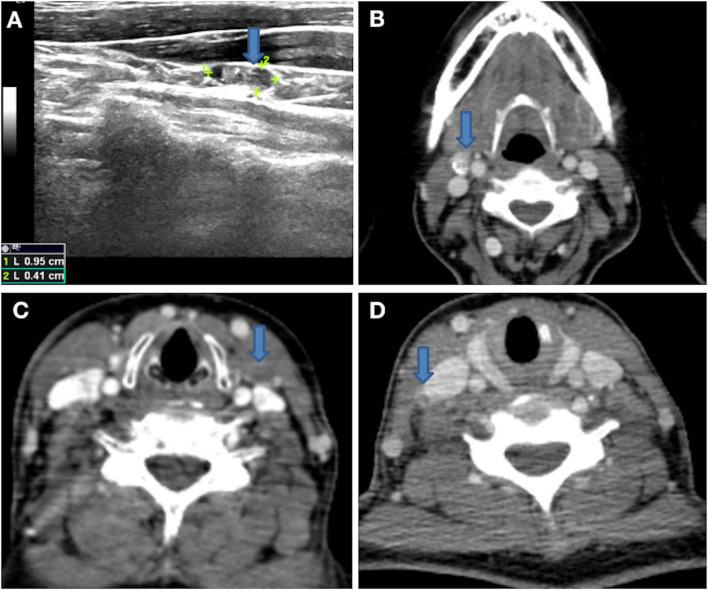 Figure 1