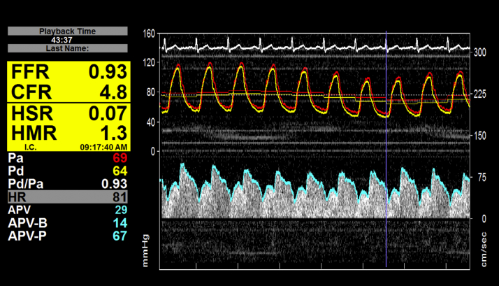 Figure 1