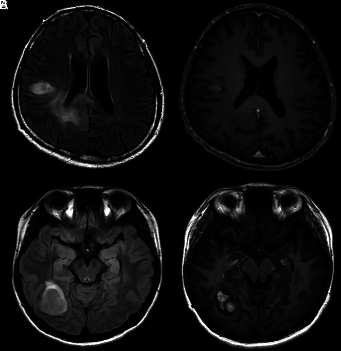 FIG 2.