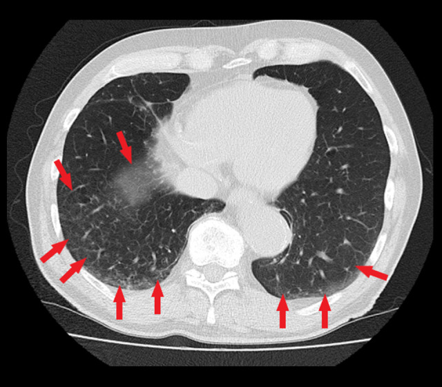 Figure 6.