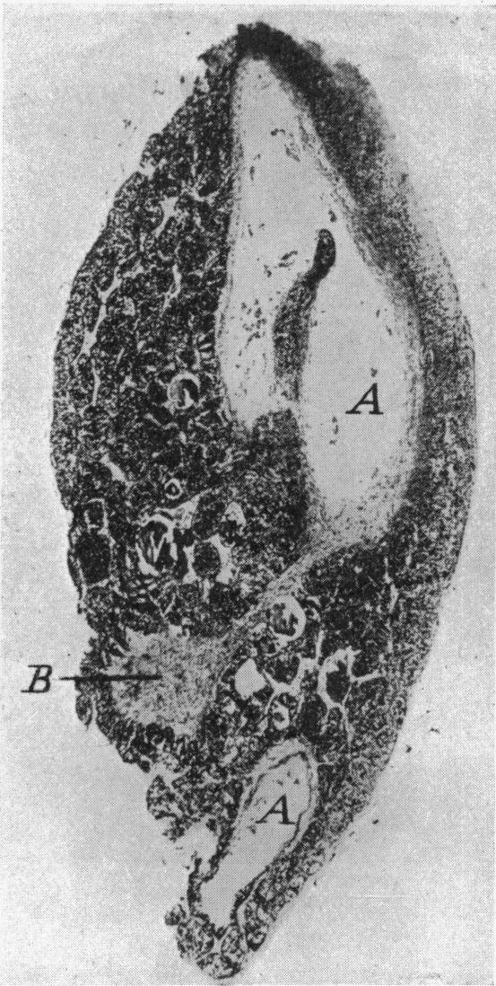 Fig. 12