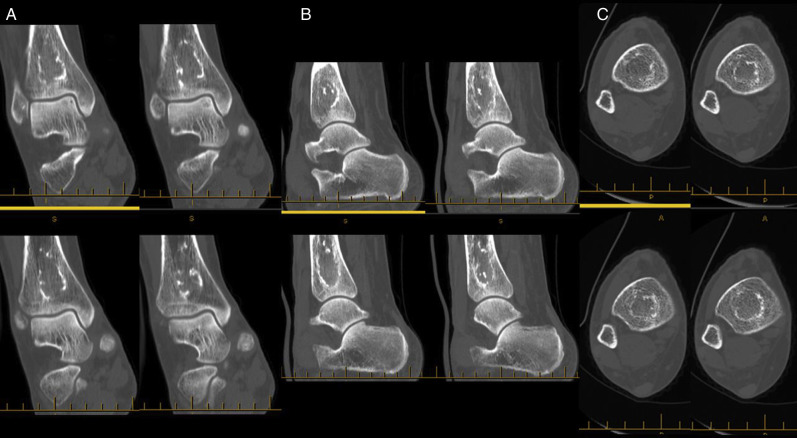 Fig. 2