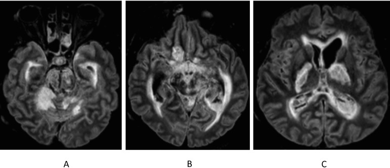 FIG 2