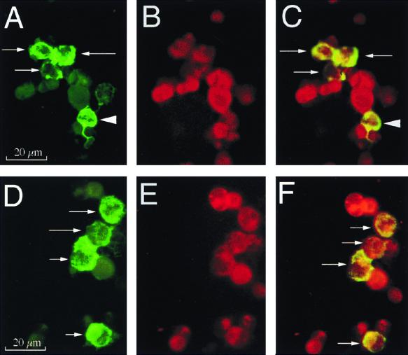 FIG. 4