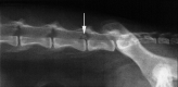 Fig 1a.