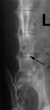 Fig 1b.