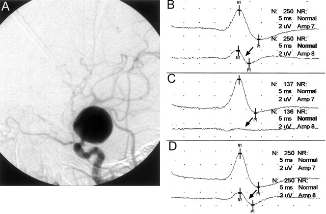 Fig 2.