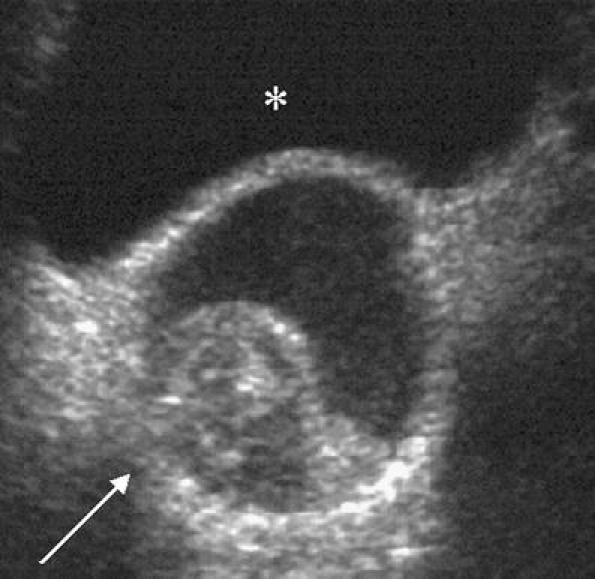 Fig. 14