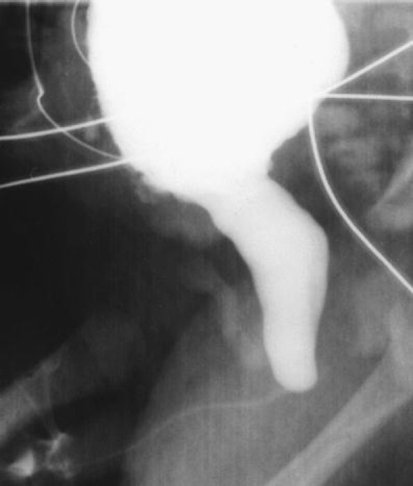 Fig. 10