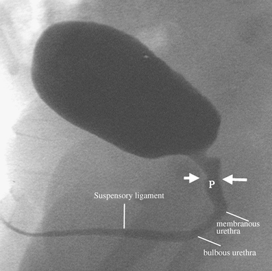 Fig. 6