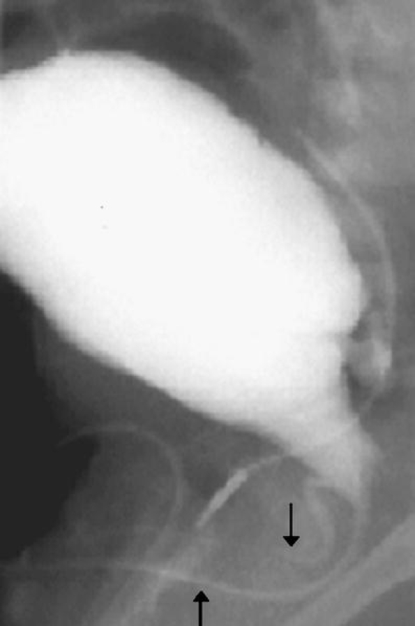Fig. 19