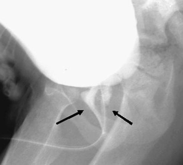 Fig. 20