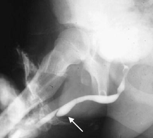Fig. 16
