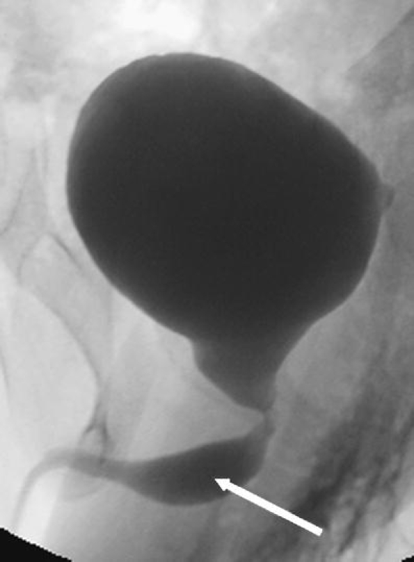 Fig. 18
