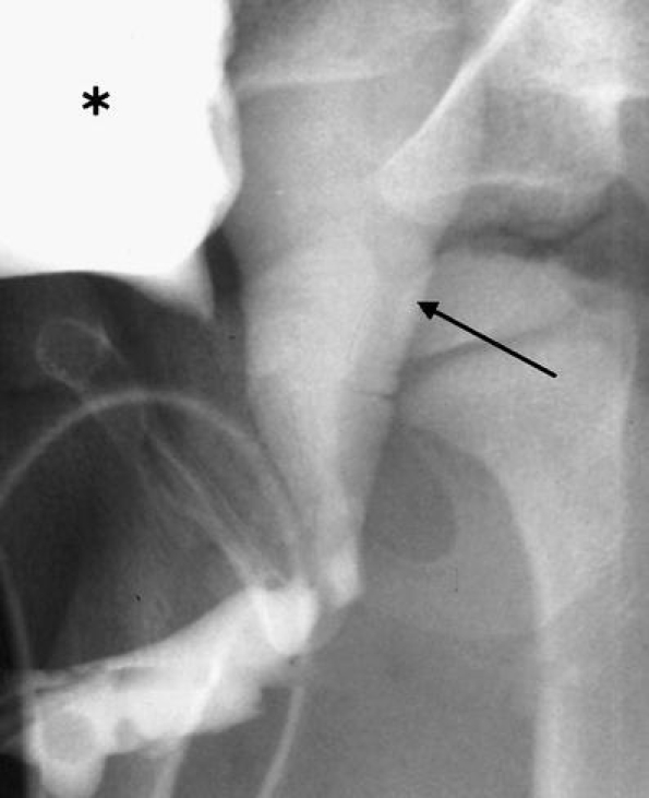Fig. 13
