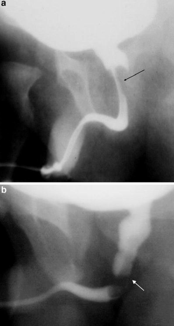 Fig. 11