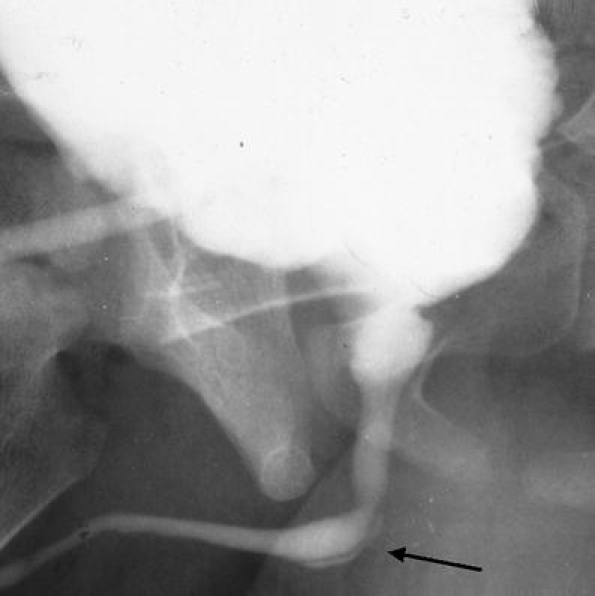 Fig. 15