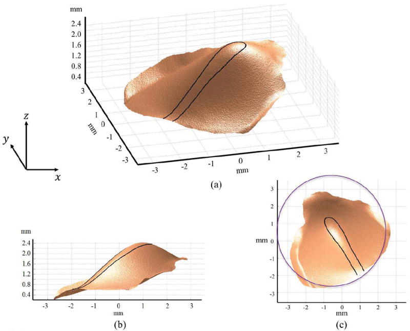 Fig.11