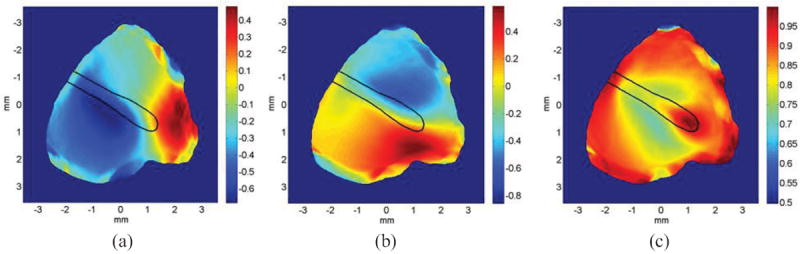 Fig.12