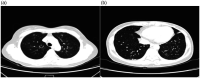 Figure 11.