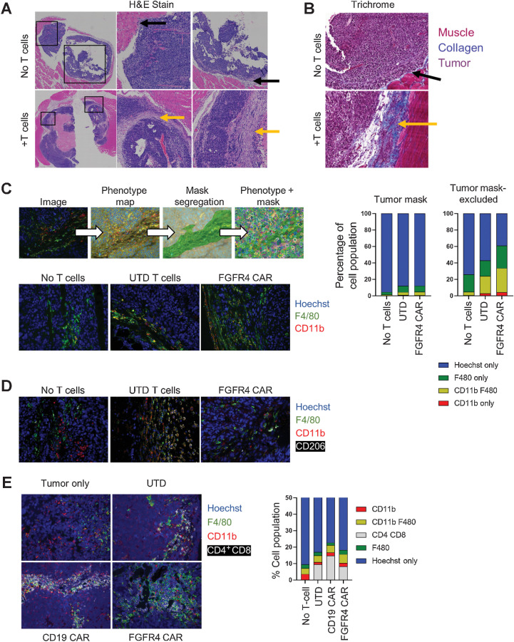 Figure 5. T-cell therapy induces tumor stroma formation. A and B, Untreated or T-cell–treated intramuscular RH30_19 tumors were excised and stained with H&E, with central and right showing enlargements of the indicated boxed areas (A) or TriChrome stained to highlight collagen deposition (blue; B). Yellow arrows indicate regions of stroma/collagen deposition as opposed to the tumor–stromal interface in untreated mice (black arrows). C, Untreated or T-cell–treated RH30_19 tumors were stained with α-Luciferase (tumor), mouse α-CD11b, and α-F4/80. A phenotype map was created to indicate the identity of each cell within the field of view. Luciferase staining was used to determine tumor cells and create a mask of tumor and non-tumor regions. Myeloid cells were counted within both regions (phenotype + mask) as demonstrated. The proportion of myeloid cells in untreated, T-cell–treated, or anti-FGFR4 CAR–treated mice is shown in the representative images and plotted to the right. D, The presence of tumor-associated macrophages was determined with immunofluorescence staining of CD206 along with CD11b and F4/80 in RH30_19 tumors excised from untreated, untransduced T-cell, or FGFR4 CAR T-cell–treated mice. E, CD4 and CD8 T cells localized to myeloid-rich regions as shown by immunofluorescent staining with CD4+CD8, CD11b, and F4/80 in RH30_19 tumor samples with the indicated treatments.