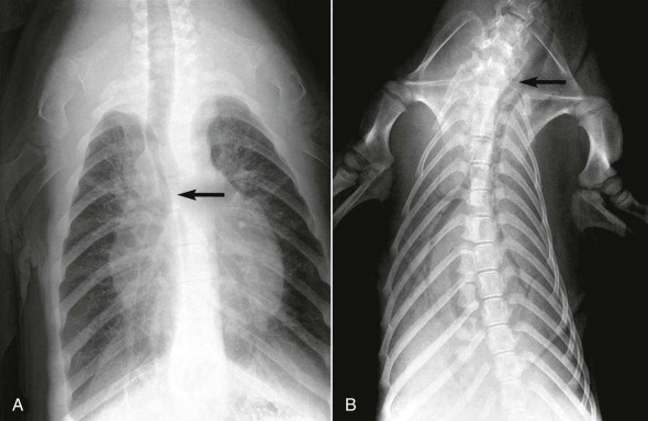 FIGURE 44-2
