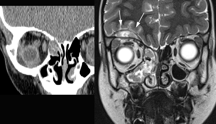 Figure 17